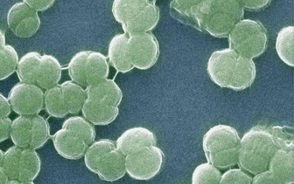 insights into the evolution of far-red light photosynthesis