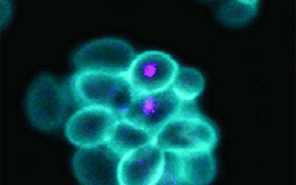 Bacterium Breakthrough Points to New Path for Battery Self-Recycling